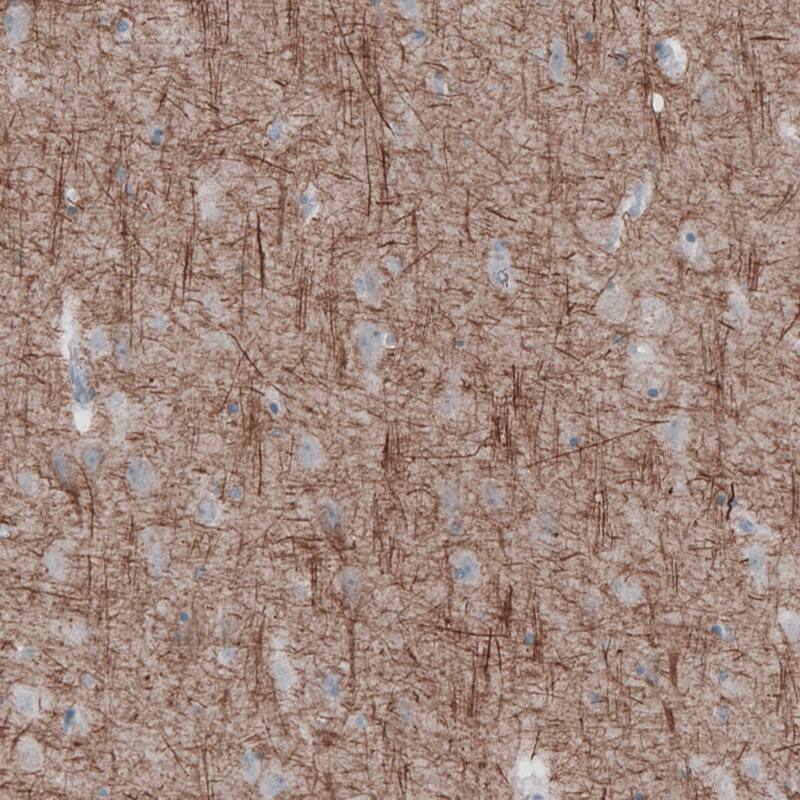 NF-L Antibody (CL4729) - Azide and BSA Free Immunohistochemistry-Paraffin: NF-L Antibody [NBP3-44128]