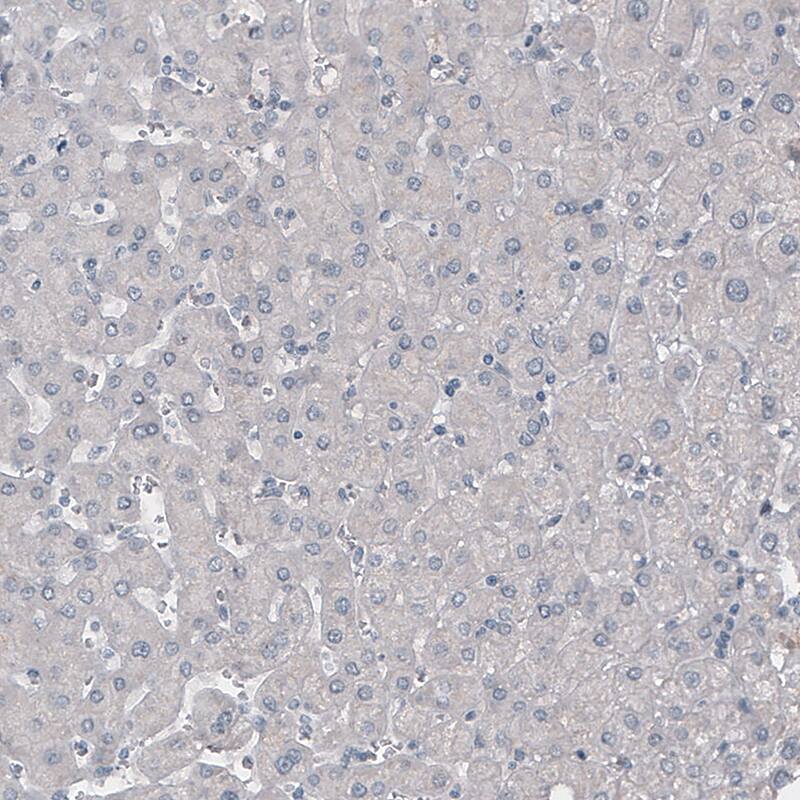 NF-L Antibody (CL4729) - Azide and BSA Free Immunohistochemistry-Paraffin: NF-L Antibody [NBP3-44128]