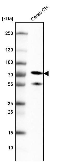 NF-L Antibody (CL4729) - Azide and BSA Free Western Blot: NF-L Antibody [NBP3-44128]