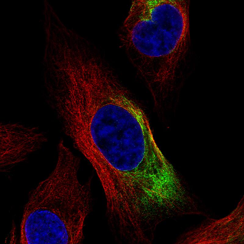 NF-L Antibody (CL4729) - Azide and BSA Free Immunocytochemistry/ Immunofluorescence: NF-L Antibody [NBP3-44128]