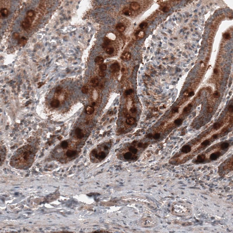 RBCK1 Antibody (CL4289) - Azide and BSA Free Immunohistochemistry-Paraffin: RBCK1 Antibody [NBP3-44129]