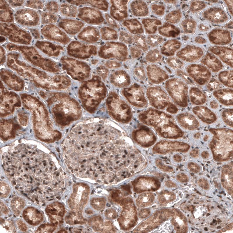 RBCK1 Antibody (CL4289) - Azide and BSA Free Immunohistochemistry-Paraffin: RBCK1 Antibody [NBP3-44129]