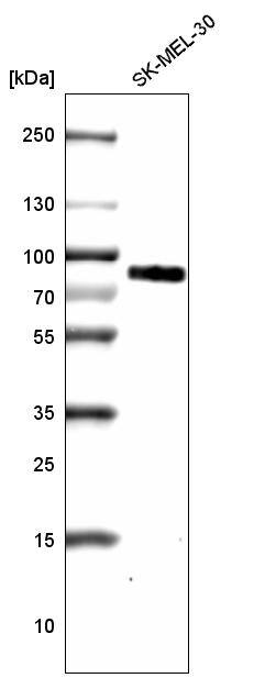 TYRP1 Antibody (CL4906) - Azide and BSA Free Western Blot: TYRP1 Antibody [NBP3-44131]
