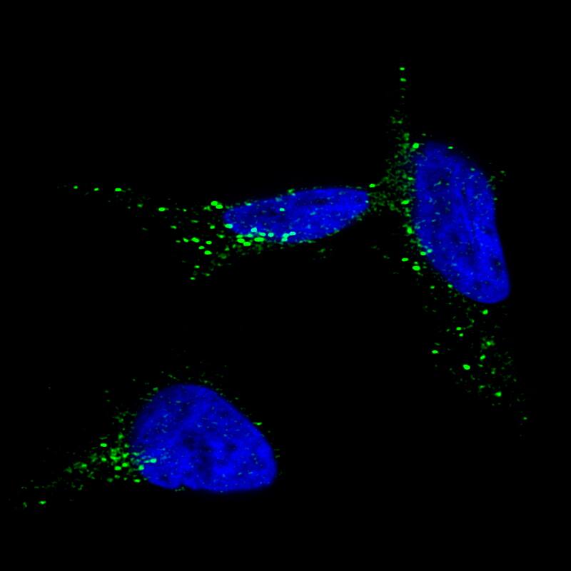 TYRP1 Antibody (CL4906) - Azide and BSA Free Immunocytochemistry/ Immunofluorescence: TYRP1 Antibody [NBP3-44131]
