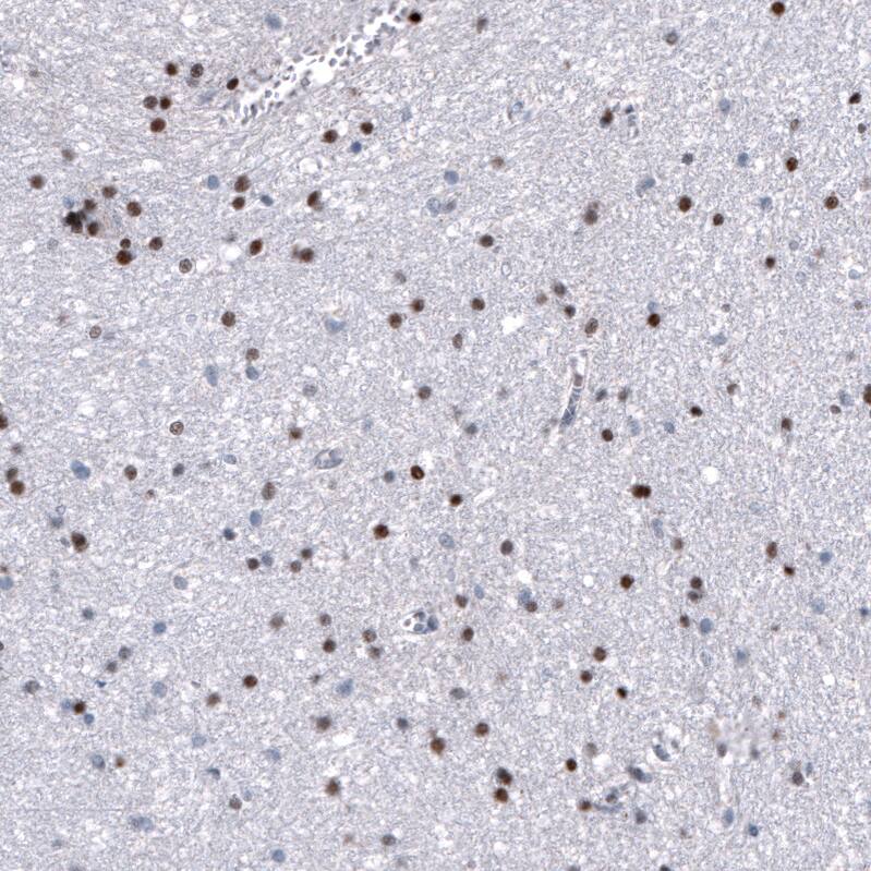 NKX2.2 Antibody (CL11380) - Azide and BSA Free Immunohistochemistry-Paraffin: NKX2.2 Antibody [NBP3-44133]