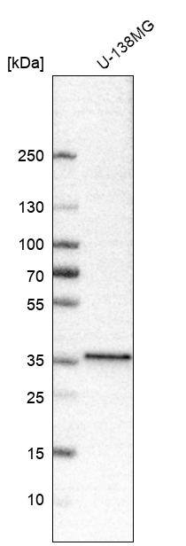 NKX2.2 Antibody (CL11380) - Azide and BSA Free Western Blot: NKX2.2 Antibody [NBP3-44133]