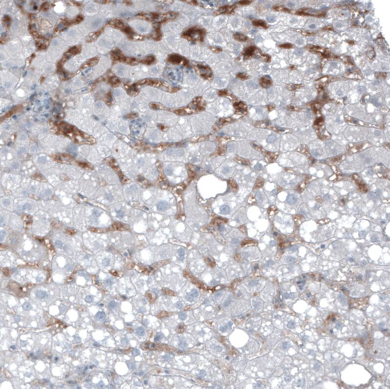 alpha-Fetoprotein/AFP Antibody (CL9772) - Azide and BSA Free Immunohistochemistry-Paraffin: alpha-Fetoprotein/AFP Antibody [NBP3-44134]