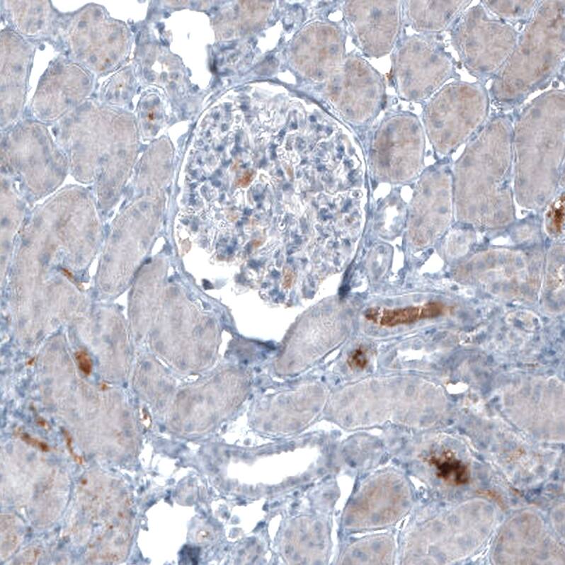 alpha-Fetoprotein/AFP Antibody (CL9772) - Azide and BSA Free Immunohistochemistry-Paraffin: alpha-Fetoprotein/AFP Antibody [NBP3-44134]