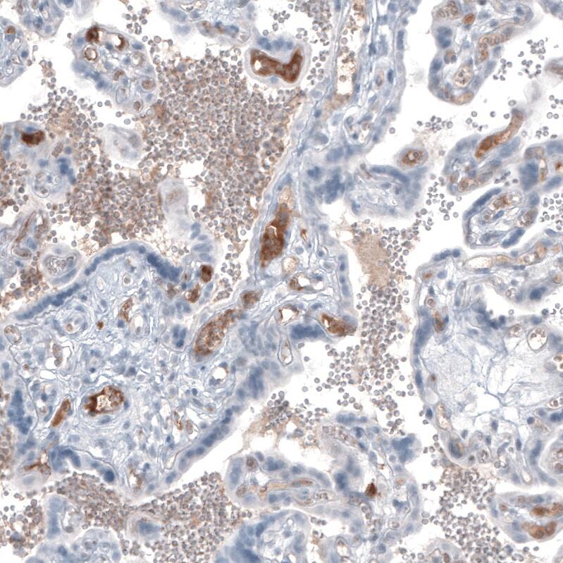 alpha-Fetoprotein/AFP Antibody (CL9772) - Azide and BSA Free Immunohistochemistry-Paraffin: alpha-Fetoprotein/AFP Antibody [NBP3-44134]