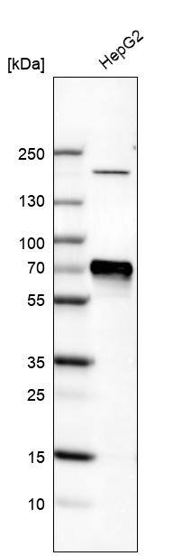 alpha-Fetoprotein/AFP Antibody (CL9766) - Azide and BSA Free Western Blot: alpha-Fetoprotein/AFP Antibody [NBP3-44135]