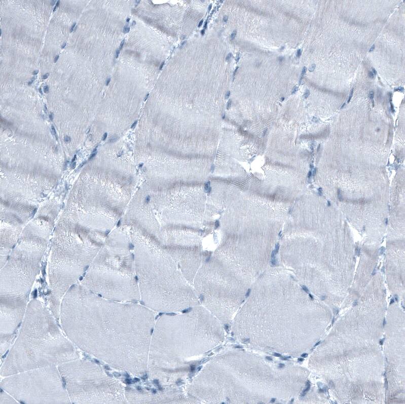 alpha-Fetoprotein/AFP Antibody (CL9766) - Azide and BSA Free Immunohistochemistry-Paraffin: alpha-Fetoprotein/AFP Antibody [NBP3-44135]