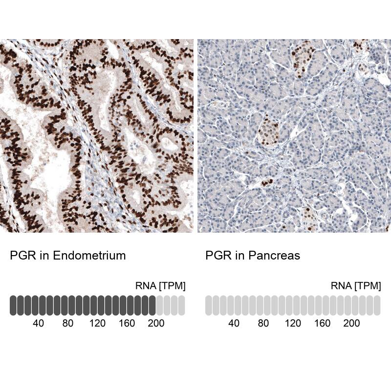 Progesterone R B/NR3C3 Antibody (CL8721) - Azide and BSA Free Immunohistochemistry-Paraffin: Progesterone R B/NR3C3 Antibody [NBP3-44136]