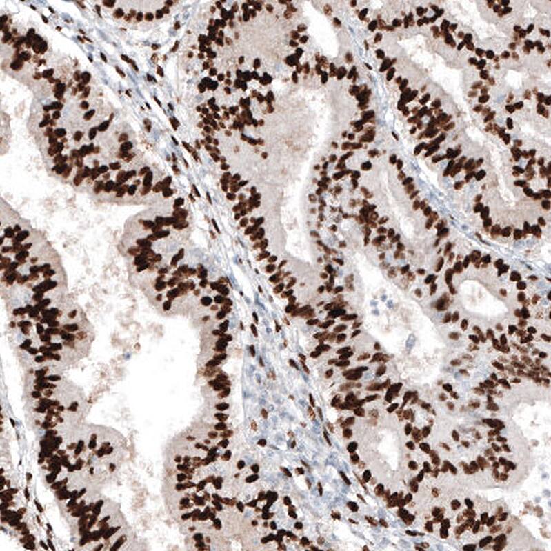 Progesterone R B/NR3C3 Antibody (CL8721) - Azide and BSA Free Immunohistochemistry-Paraffin: Progesterone R B/NR3C3 Antibody [NBP3-44136]