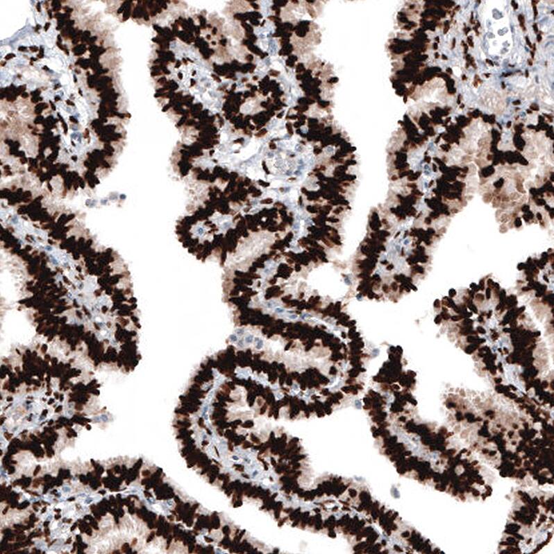 Progesterone R B/NR3C3 Antibody (CL8721) - Azide and BSA Free Immunohistochemistry-Paraffin: Progesterone R B/NR3C3 Antibody [NBP3-44136]