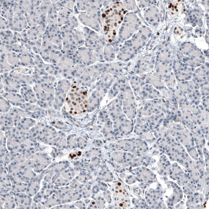 Progesterone R B/NR3C3 Antibody (CL8721) - Azide and BSA Free Immunohistochemistry-Paraffin: Progesterone R B/NR3C3 Antibody [NBP3-44136]