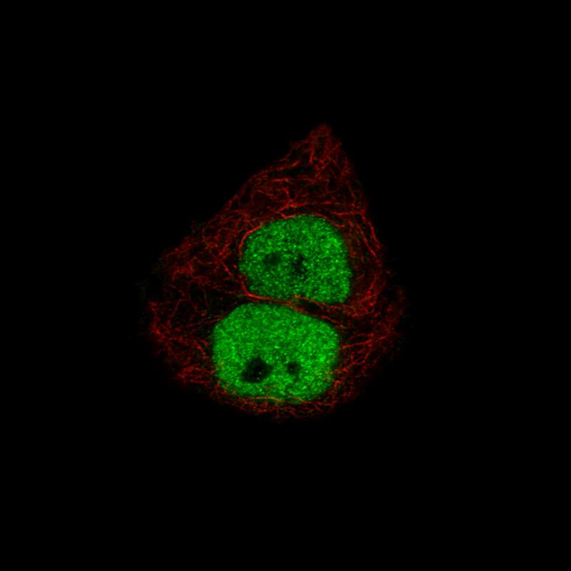 Progesterone R B/NR3C3 Antibody (CL8721) - Azide and BSA Free Immunocytochemistry/ Immunofluorescence: Progesterone R B/NR3C3 Antibody [NBP3-44136]
