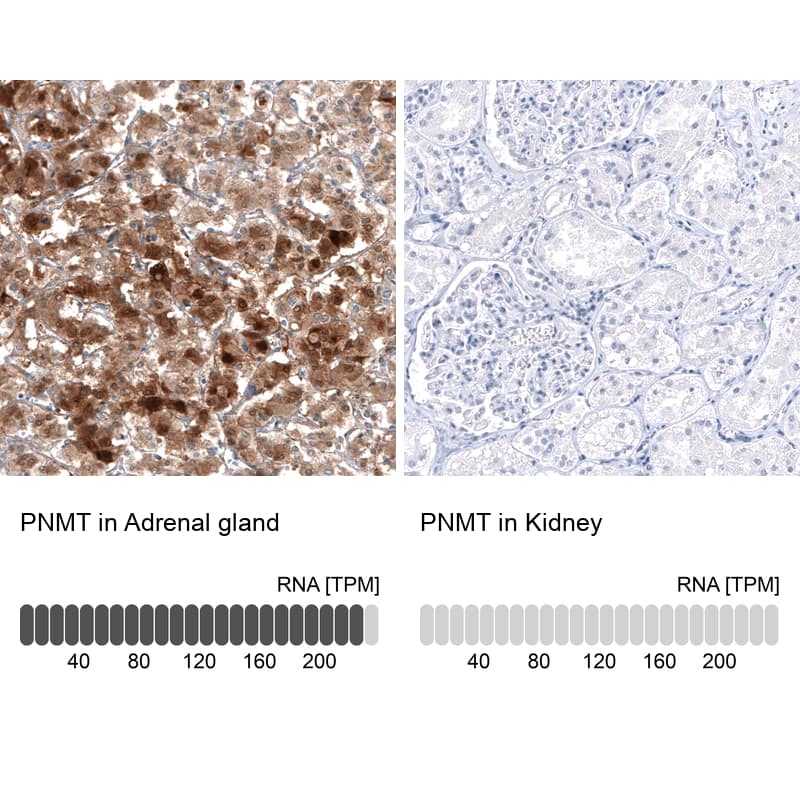 PNMT Antibody (CL11434) - Azide and BSA Free Immunohistochemistry-Paraffin: PNMT Antibody [NBP3-44139]