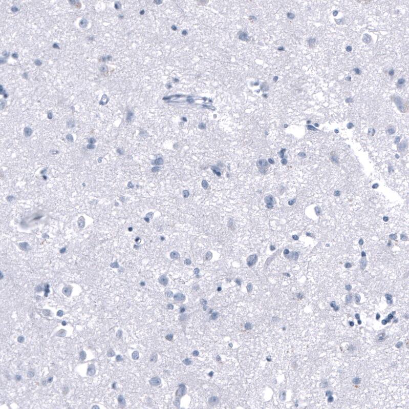 PNMT Antibody (CL11434) - Azide and BSA Free Immunohistochemistry-Paraffin: PNMT Antibody [NBP3-44139]