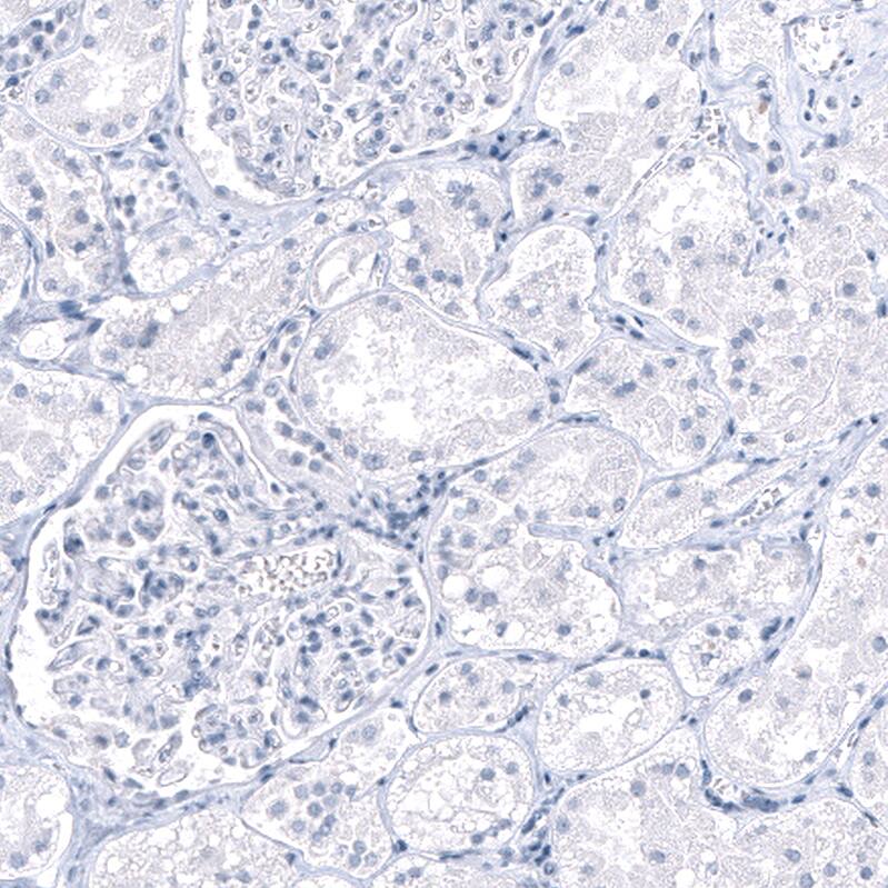 PNMT Antibody (CL11434) - Azide and BSA Free Immunohistochemistry-Paraffin: PNMT Antibody [NBP3-44139]