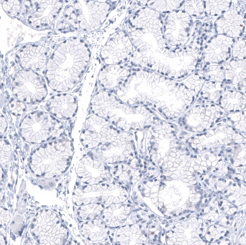 PNMT Antibody (CL11434) - Azide and BSA Free Immunohistochemistry-Paraffin: PNMT Antibody [NBP3-44139]