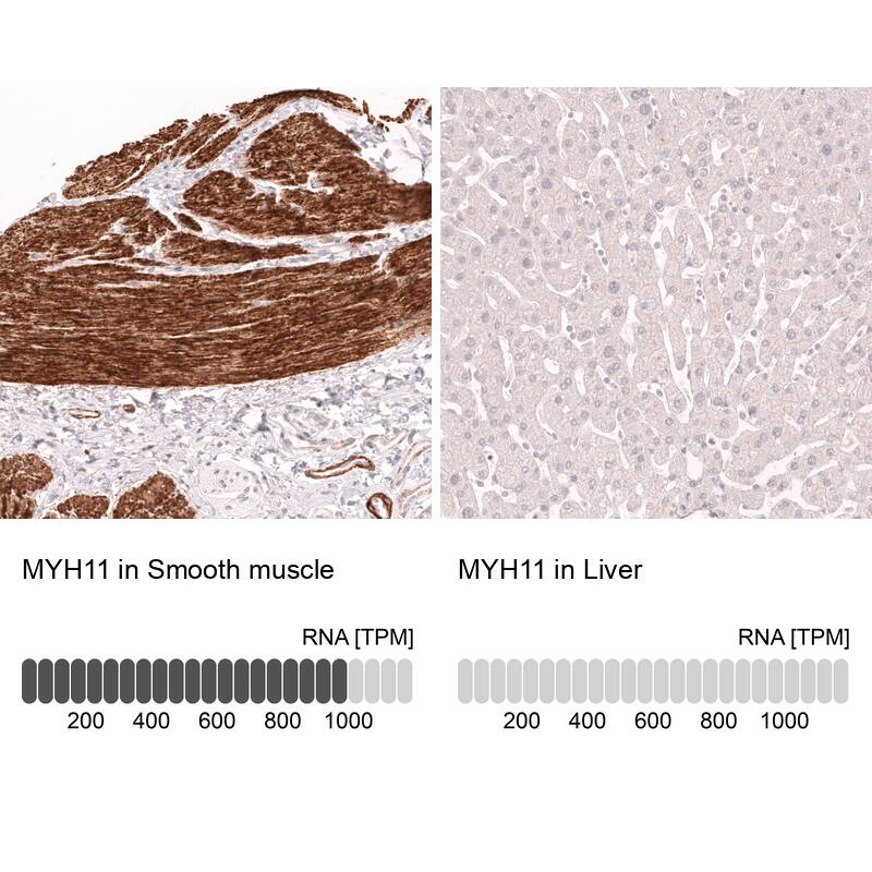 Myosin heavy chain 11 Antibody (CL14617) - Azide and BSA Free Immunohistochemistry-Paraffin: Myosin heavy chain 11 Antibody [NBP3-44140]