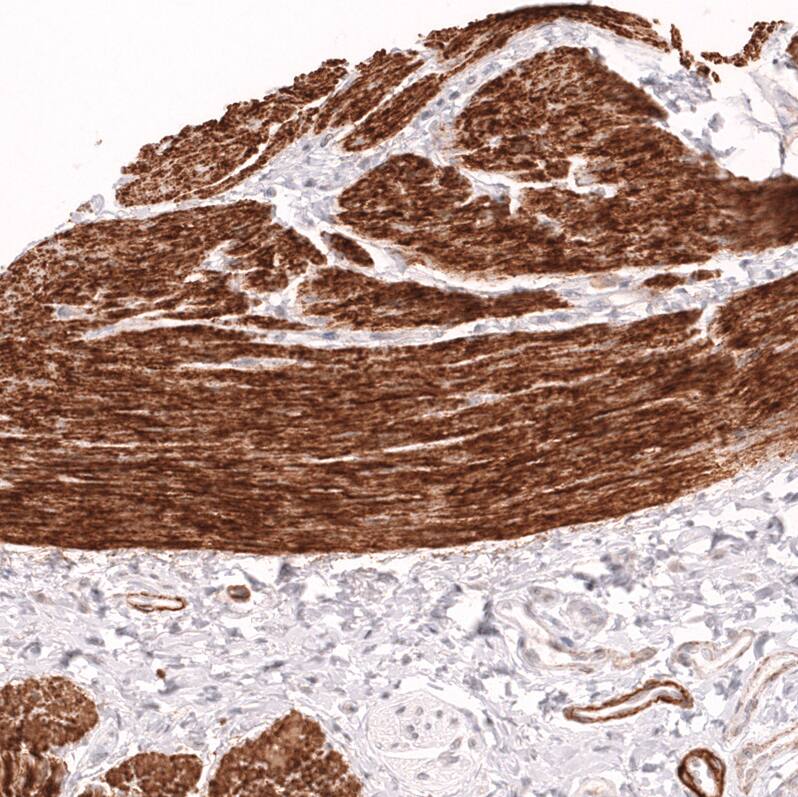 Myosin heavy chain 11 Antibody (CL14617) - Azide and BSA Free Immunohistochemistry-Paraffin: Myosin heavy chain 11 Antibody [NBP3-44140]
