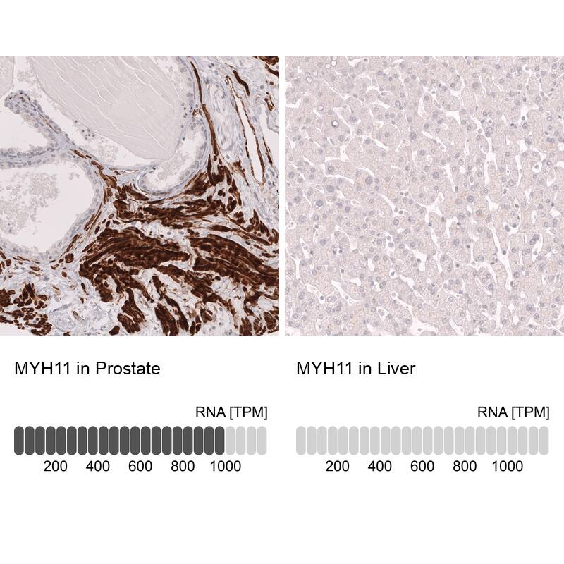 Myosin heavy chain 11 Antibody (CL14619) - Azide and BSA Free Immunohistochemistry-Paraffin: Myosin heavy chain 11 Antibody [NBP3-44141]