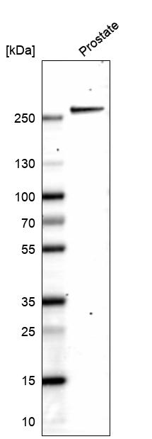 Myosin heavy chain 11 Antibody (CL14619) - Azide and BSA Free Western Blot: Myosin heavy chain 11 Antibody [NBP3-44141]