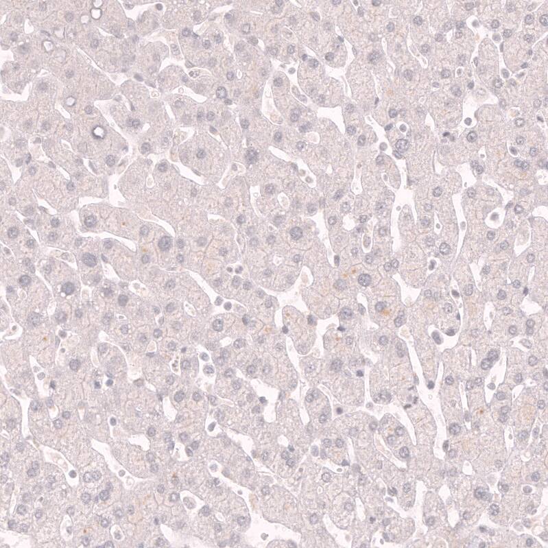 Myosin heavy chain 11 Antibody (CL14619) - Azide and BSA Free Immunohistochemistry-Paraffin: Myosin heavy chain 11 Antibody [NBP3-44141]
