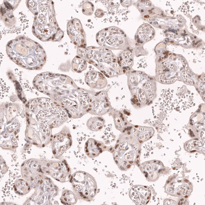 Bcl-6 Antibody (CL14611) - Azide and BSA Free Immunohistochemistry-Paraffin: Bcl-6 Antibody [NBP3-44142]