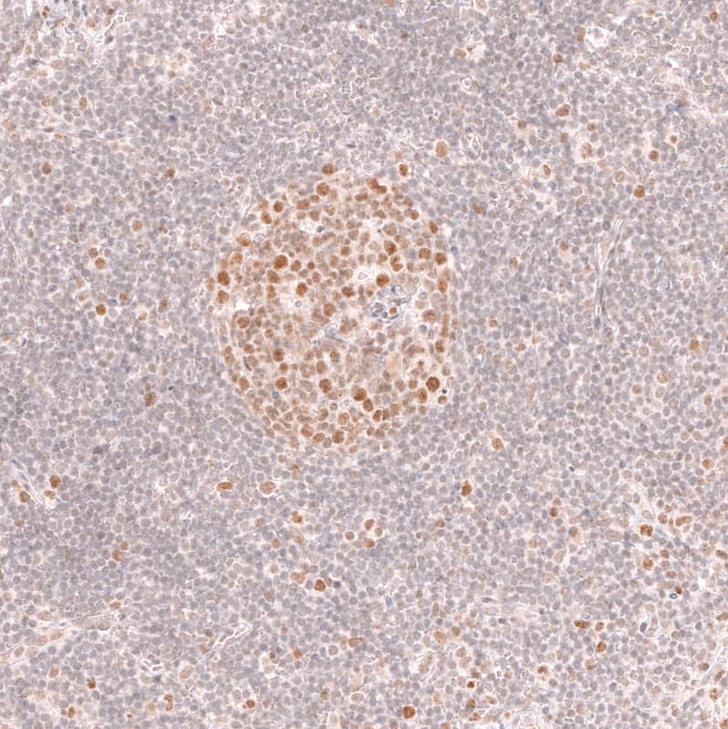 Bcl-6 Antibody (CL14611) - Azide and BSA Free Immunohistochemistry-Paraffin: Bcl-6 Antibody [NBP3-44142]