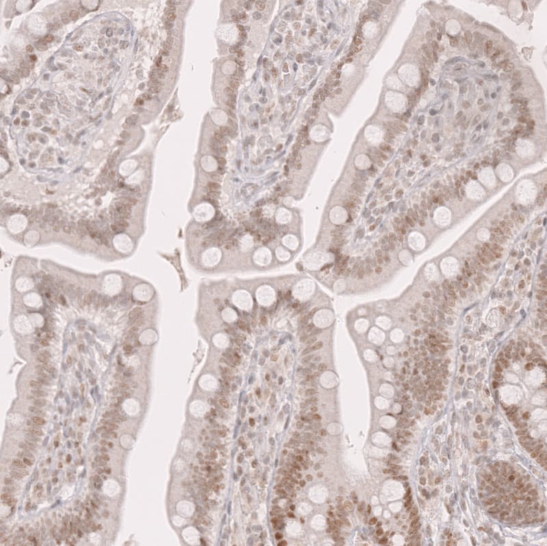 Bcl-6 Antibody (CL14611) - Azide and BSA Free Immunohistochemistry-Paraffin: Bcl-6 Antibody [NBP3-44142]