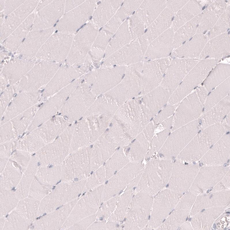 IRF4 Antibody (CL14615) - Azide and BSA Free Immunohistochemistry-Paraffin: IRF4 Antibody [NBP3-44146]
