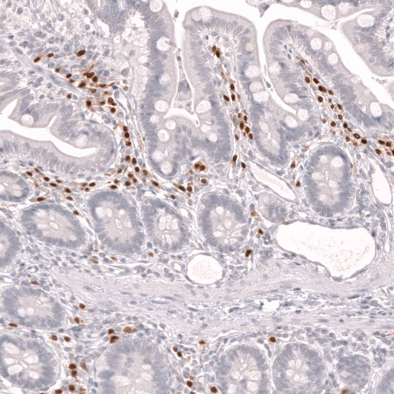 IRF4 Antibody (CL14615) - Azide and BSA Free Immunohistochemistry-Paraffin: IRF4 Antibody [NBP3-44146]