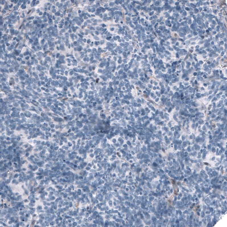 OTP Antibody (CL11222) - Azide and BSA Free Immunohistochemistry-Paraffin: OTP Antibody [NBP3-44147]