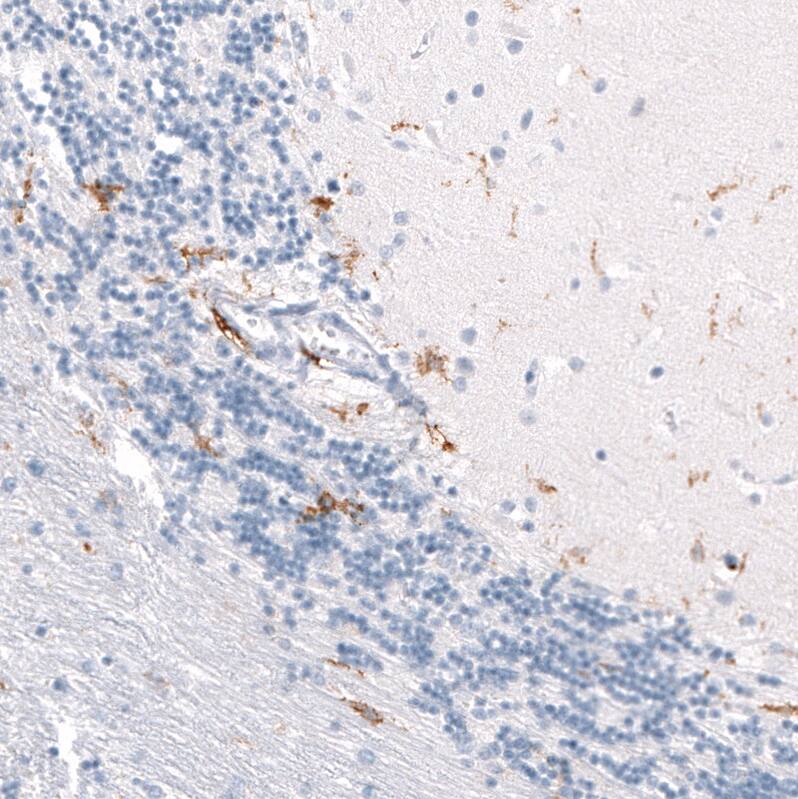 CD163 Antibody (CL10658) - Azide and BSA Free Immunohistochemistry-Paraffin: CD163 Antibody [NBP3-44148]