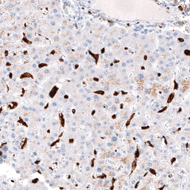CD163 Antibody (CL10658) - Azide and BSA Free Immunohistochemistry-Paraffin: CD163 Antibody [NBP3-44148]