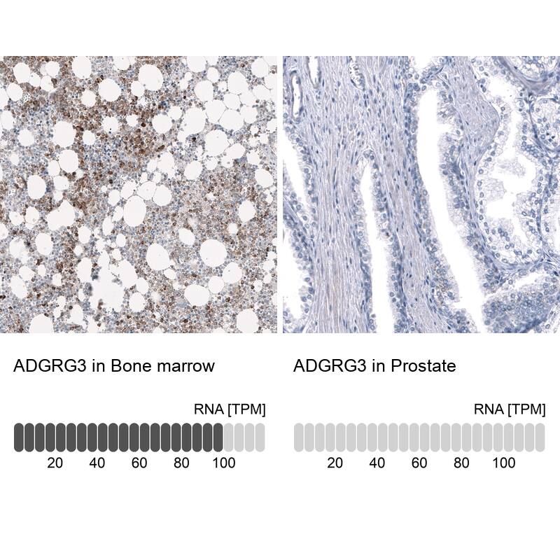 GPR97 Antibody (CL11474) - Azide and BSA Free Immunohistochemistry-Paraffin: GPR97 Antibody [NBP3-44149]