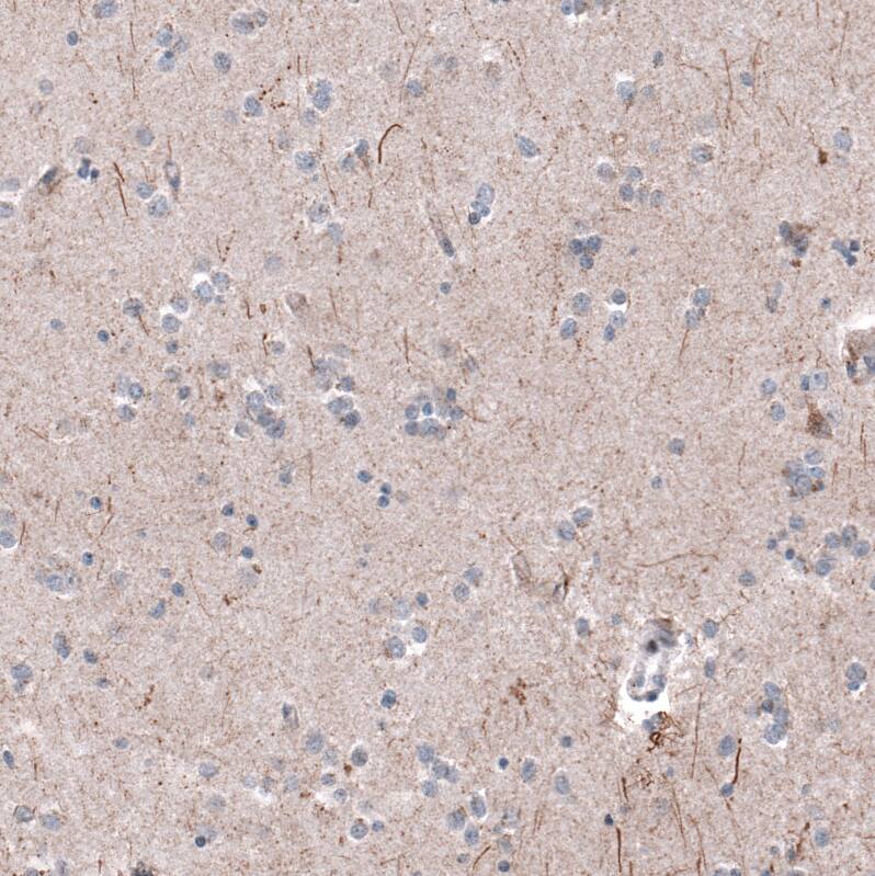 P2X7/P2RX7 Antibody (CL11508) - Azide and BSA Free Immunohistochemistry-Paraffin: P2X7/P2RX7 Antibody [NBP3-44150]