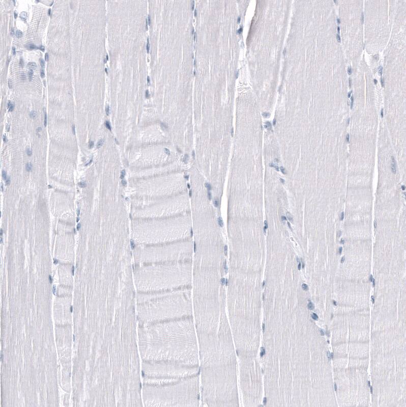 TMPRSS2 Antibody (CL12514) - Azide and BSA Free Immunohistochemistry-Paraffin: TMPRSS2 Antibody [NBP3-44152]