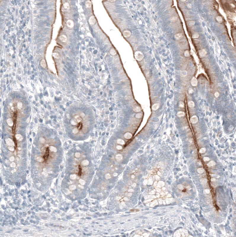 TMPRSS2 Antibody (CL12512) - Azide and BSA Free Immunohistochemistry-Paraffin: TMPRSS2 Antibody [NBP3-44153]