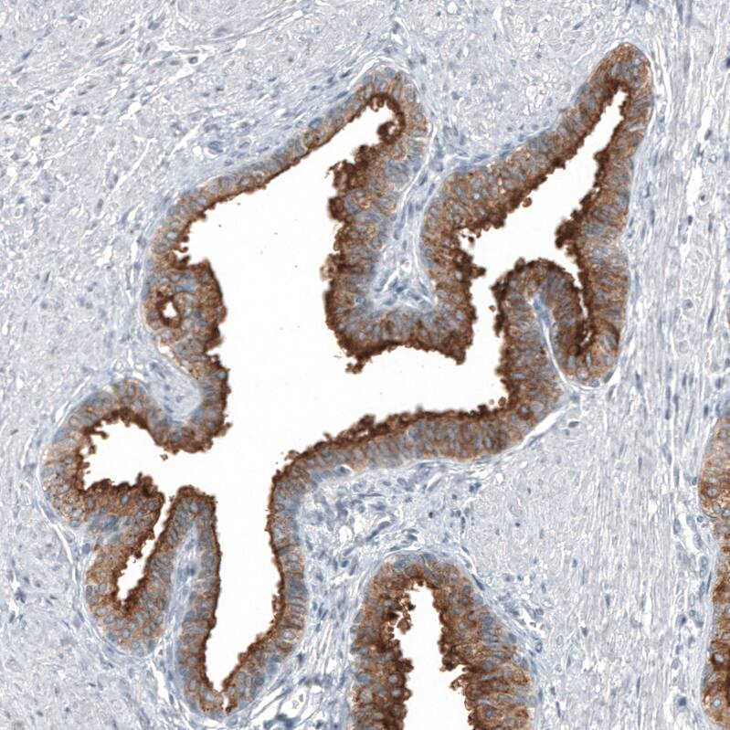 TMPRSS2 Antibody (CL12511) - Azide and BSA Free Immunohistochemistry-Paraffin: TMPRSS2 Antibody [NBP3-44154]