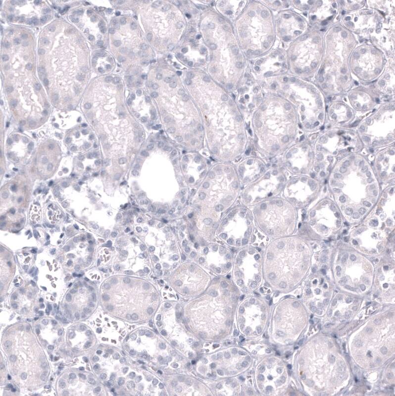 EOMES Antibody (CL15426) - Azide and BSA Free Immunohistochemistry-Paraffin: EOMES Antibody [NBP3-44156]