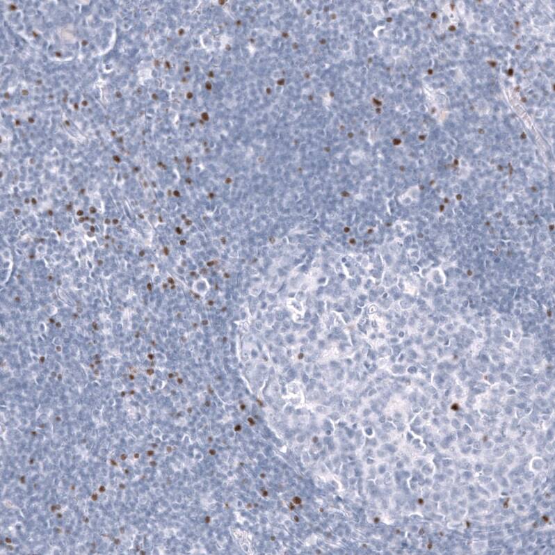 EOMES Antibody (CL15426) - Azide and BSA Free Immunohistochemistry-Paraffin: EOMES Antibody [NBP3-44156]