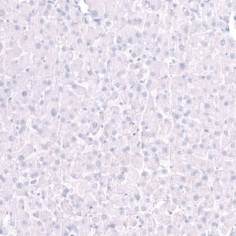 EOMES Antibody (CL15426) - Azide and BSA Free Immunohistochemistry-Paraffin: EOMES Antibody [NBP3-44156]