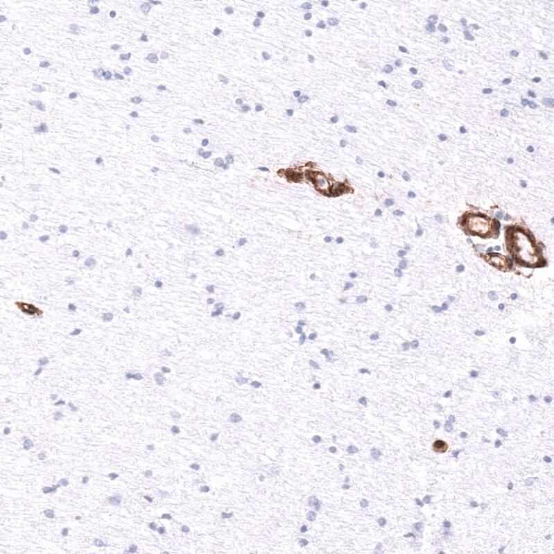 Integrin beta 1/CD29 Antibody (CL15606) - Azide and BSA Free Immunohistochemistry-Paraffin: Integrin beta 1/CD29 Antibody [NBP3-44157]