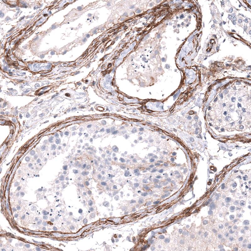 Integrin beta 1/CD29 Antibody (CL15606) - Azide and BSA Free Immunohistochemistry-Paraffin: Integrin beta 1/CD29 Antibody [NBP3-44157]