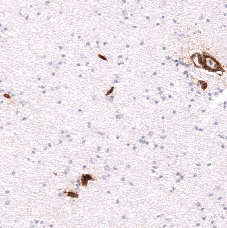 Integrin beta 1/CD29 Antibody (CL15622) - Azide and BSA Free Immunohistochemistry-Paraffin: Integrin beta 1/CD29 Antibody [NBP3-44158]