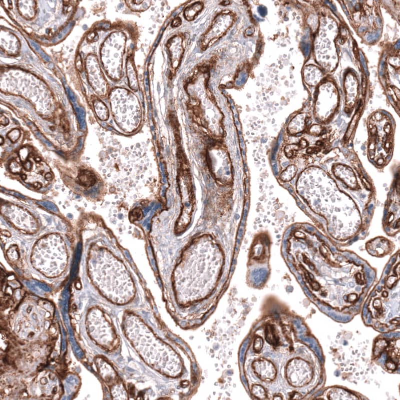 Integrin beta 1/CD29 Antibody (CL15622) - Azide and BSA Free Immunohistochemistry-Paraffin: Integrin beta 1/CD29 Antibody [NBP3-44158]