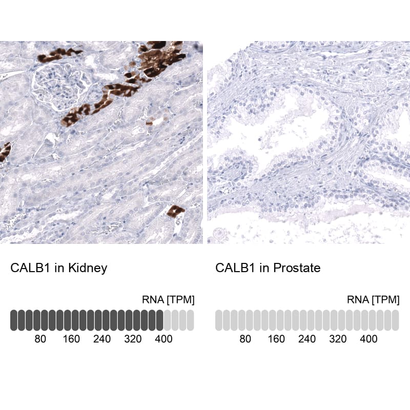 Calbindin D-28K Antibody (CL15059) - Azide and BSA Free Immunohistochemistry-Paraffin: Calbindin D-28K Antibody [NBP3-44160]